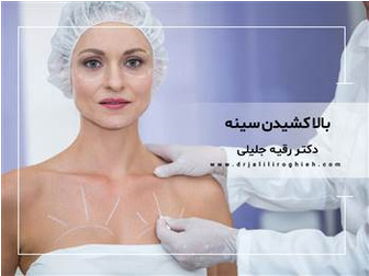 بالا کشیدن سینه